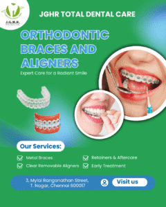 Types of Braces Available in Chennai: Metal, Ceramic, Clear Aligners & More