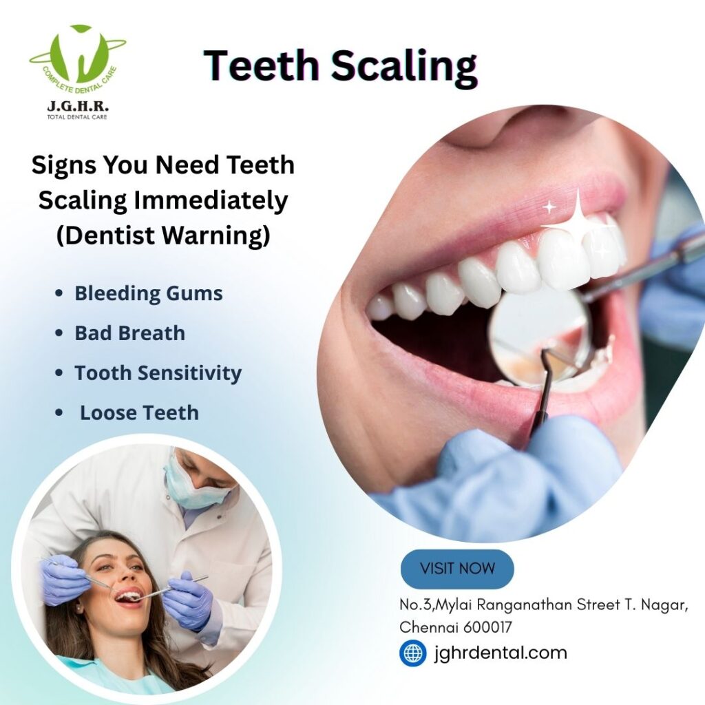 Teeth Scaling in chennai