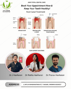 How to Choose the Best Root Canal Specialist in Chennai? Just Choose the One That’s Here for You