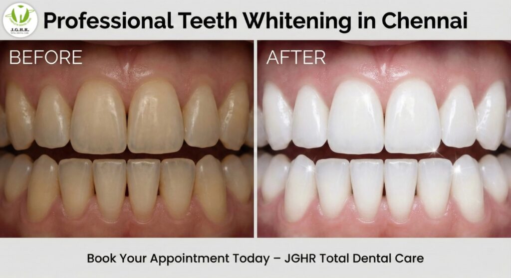 Teeth Whitening in chennai