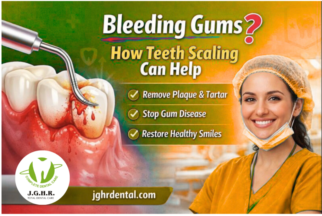 Teeth Scaling in chennai