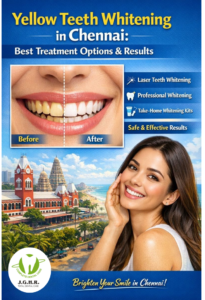 Yellow Teeth Whitening in Chennai: Best Treatment Options & Results