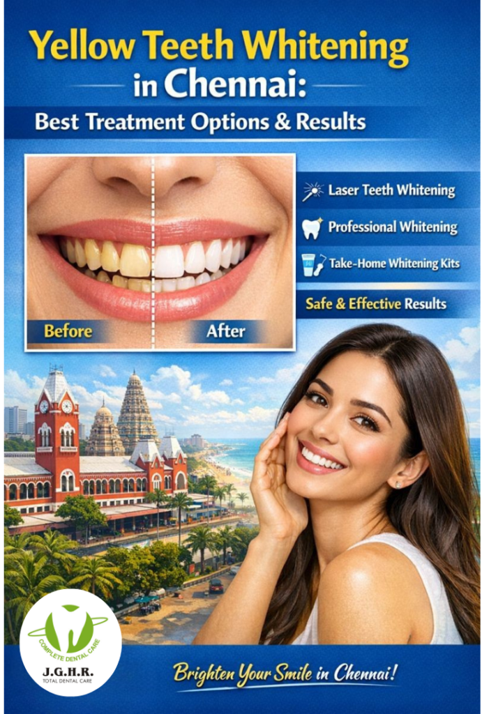 Yellow Teeth Whitening in chennai